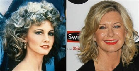 Olivia Newton John before and after plastic surgery facelift - Celebrity Plastic Surgery Gone Wrong