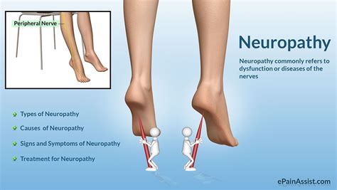 It relieves the points of compression along the nerve that in many cases is a major component of ...