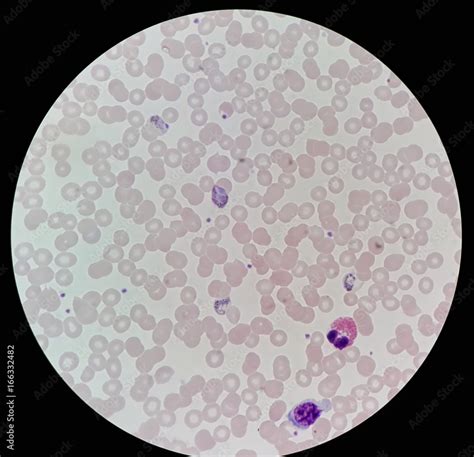 Under X Light Microscope Human Parasite On Thin Film Of Blood Smear ...