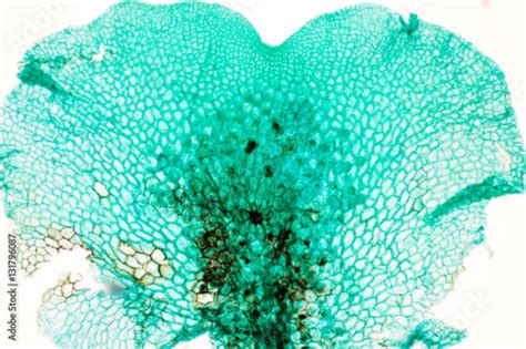 Fern, Archegonia and Antheridia under microscope view. Stock Photo ...