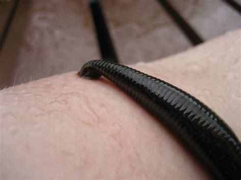 Some doctors still use leeches. This is what it's like to be treated by ...