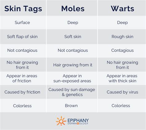 How to Tell the Difference Between Skin Tags, Moles, & Warts (2023)