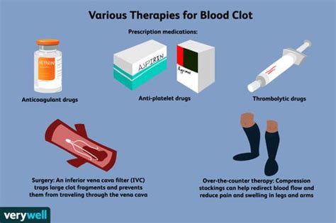 How Blood Clots Are Treated