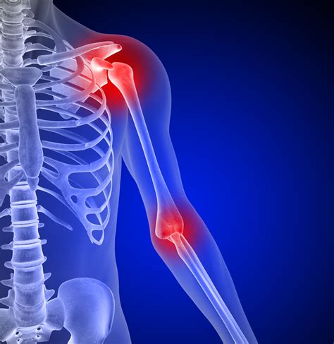 Oswestry Shoulder & Elbow Course for Registrars/Therapists - Orthopaedic Institute Ltd