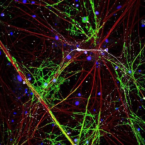 How the brain makes myelination activity-dependent