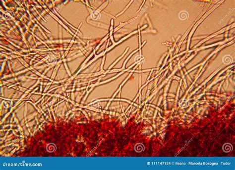 Mold at the microscope stock photo. Image of health - 111147124