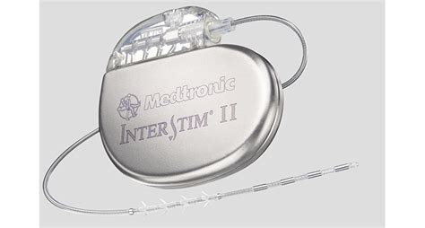 Medtronic touts 5-year data on InterStim neuromod device for OAB - MassDevice