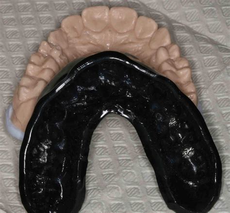 Custom Mouthguards - Glendale AZ Dentist - Dr. Lee Ann Brady