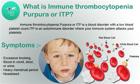 Immune Thrombocytopenia (ITP): Some Causes & Symptoms