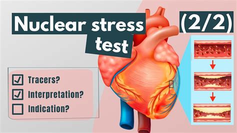 Stress Image Test