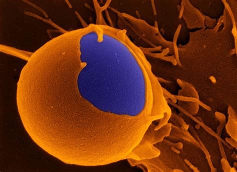 #science #art: #macrophage attacks foreign bodies under an electron # ...