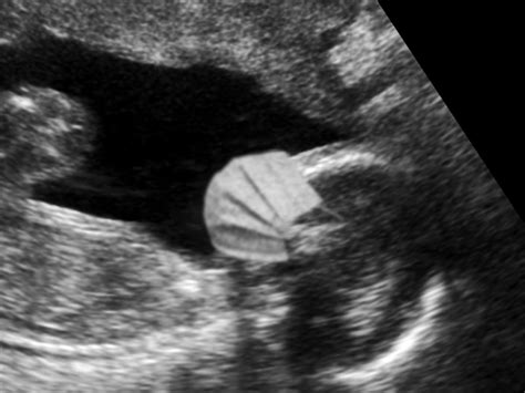 Funny Fake Ultrasound Designs | Baby Maybe