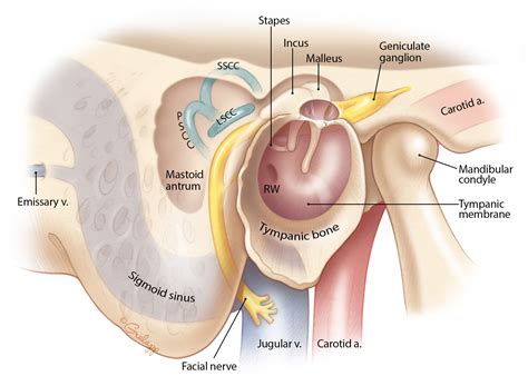 Mastoidectomy – Oto Surgery Atlas