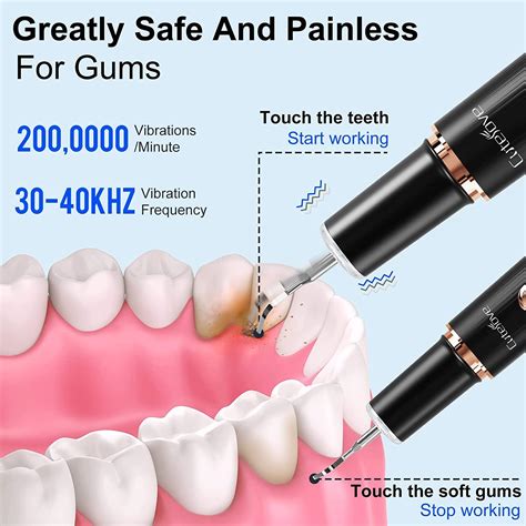 Rechargeable Dental Plaque & Tartar Remover with LED Light - 3 Modes, 4 Heads, Dental Mirror ...