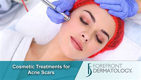 Cosmetic Treatments for Acne Scarring | Premier Dermatology