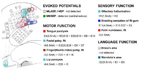 Functional brain mapping using ECoG-guided electrical stimulation with... | Download Scientific ...