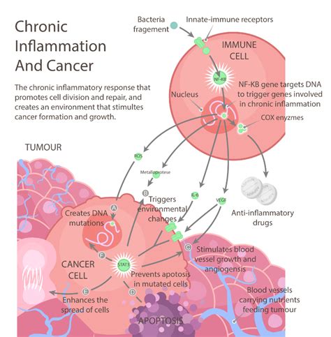 Chronic Inflammation and Cancer - Earthing Canada