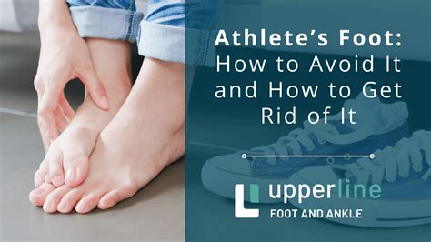 Athlete’s Foot: How to Avoid It and How to Get Rid of It