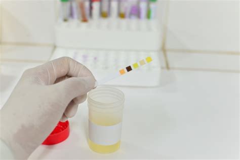 Cystitis treatment with non-antibiotic bladder infection therapies shows potential: Study