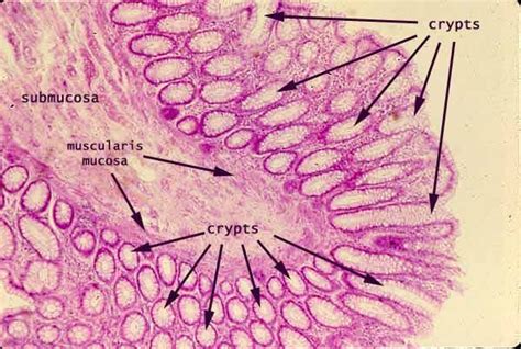 Histology - Small Intestinal Crypts | Histology - Small Intestine | Pinterest