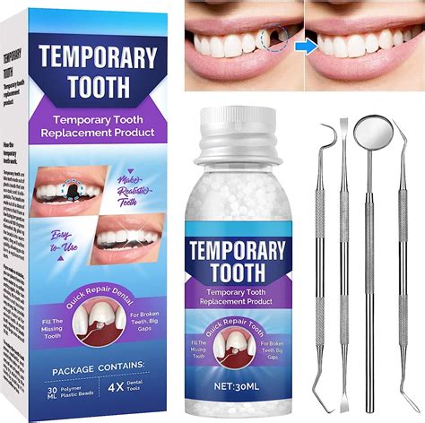 Tooth Repair Kit, Temporary Tooth Replacement Kit, Chipped Tooth Repair ...