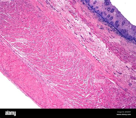 Layers of the wall of a human esophagus: mucosa (with epithelium ...