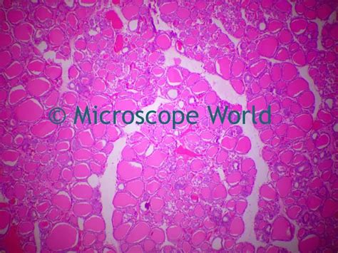 Microscope World Blog: Human Thyroid Gland