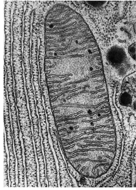 Mitochondria Micrograph