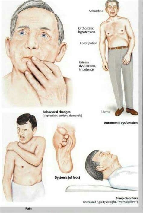 Pin on Parkinsons disease