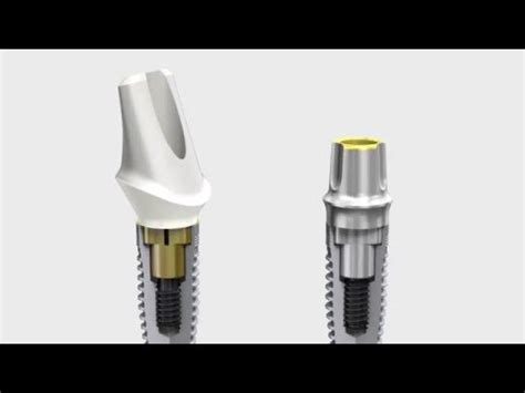 Nobel Biocare Implant Systems - YouTube