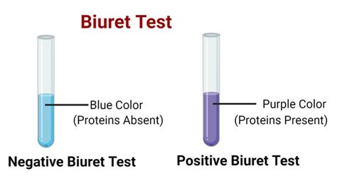 Biuret Test For Protein- Definition, Principle, Procedure, Results, Uses