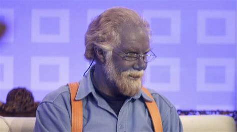 The man who turned blue after taking a dietary supplement for years