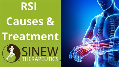 RSI Causes and Treatment - YouTube