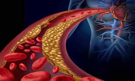 Sinusoids: Definition, Structure, Types and Functions - Scope Heal