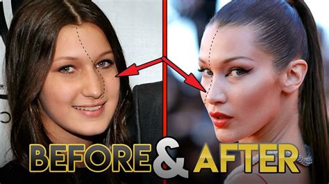 Bella Hadid | Before and After Transformations ( Plastic Surgery Rumors, Make Up, Fitness & More ...