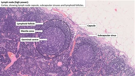 Lymph Node – Normal Histology – NUS Pathweb :: NUS Pathweb