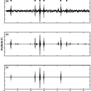 Stethoscope placement and abdominal regions: ℓ stands for the distance... | Download Scientific ...