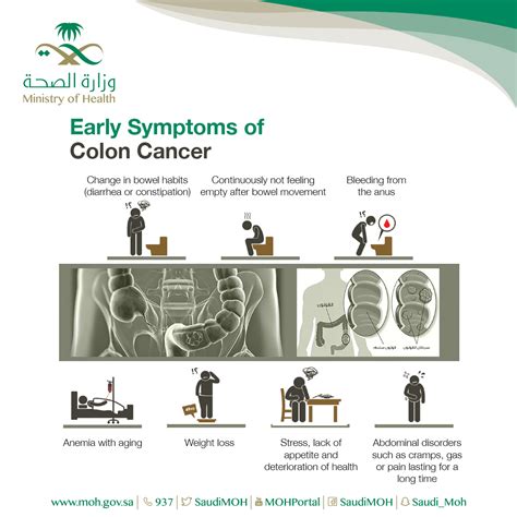 Chronic Disease - Colorectal Cancer