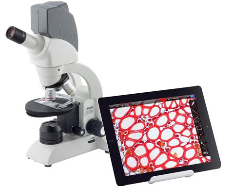 5 Best Digital Microscopes Reviewed in 2020 | SKINGROOM