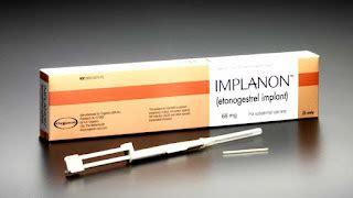 Etonogestrel birth control implant