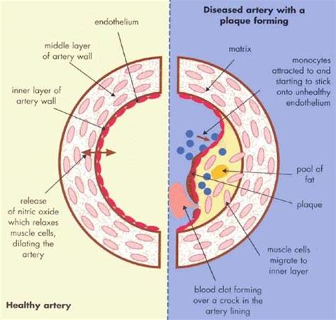 Acomplia (Rimonabant) - Investigational Agent for the Management of Obesity - Clinical Trials Arena