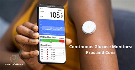 What is a Continuous Glucose Monitor?