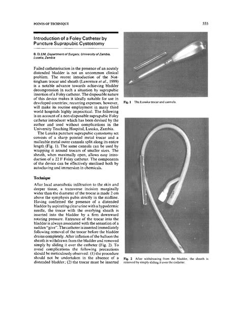 (PDF) Introduction of a Foley Catheter by Puncture Suprapubic Cystostomy - DOKUMEN.TIPS