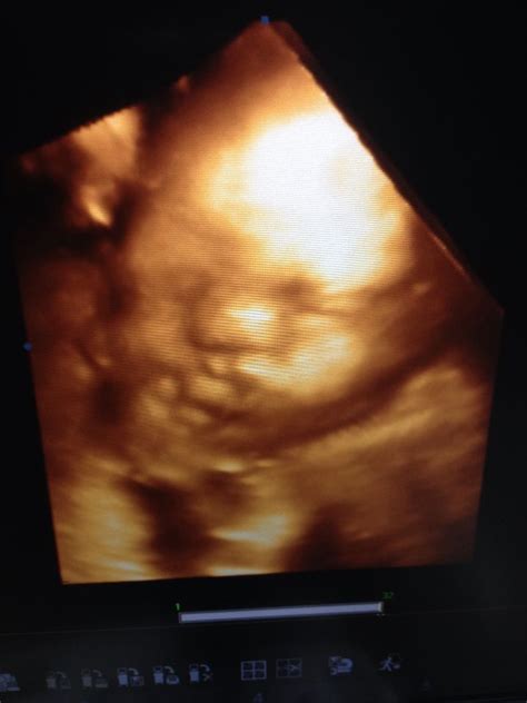 Precious pic of this baby boy at 31 weeks! | 4d ultrasound, Ultrasound, Pics