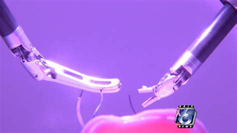 Robotics make hysterectomies easier on everyone