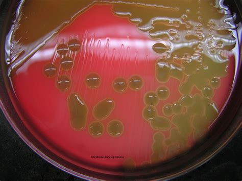 ""Streptococcus pneumoniae" alpha hemolysis on blood agar plate. Note the partial hemolysis ...