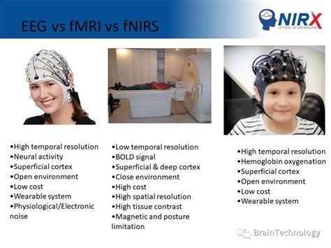 EEG vs MRI vs fMRI vs fNIRS - 长擎科技