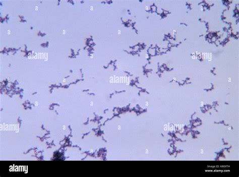 Peptostreptococcus Gram Stain