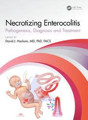 Necrotizing Enterocolitis: pathogenesis, diagnosis and treatment - 1st