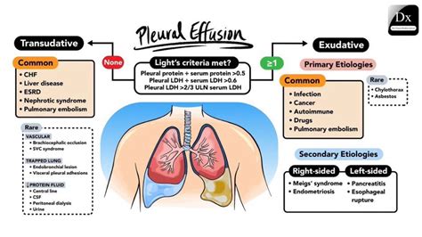 oktaaa on Twitter: "RT @Medical_MD1: Pleural Effusion Transudative vs Exudative 🧐 Great Summary ...